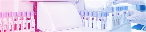 laboratory analysis belgrade|Laboratory Analyses .